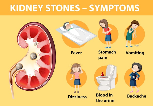 Vector kidney stones symptoms cartoon style infographic