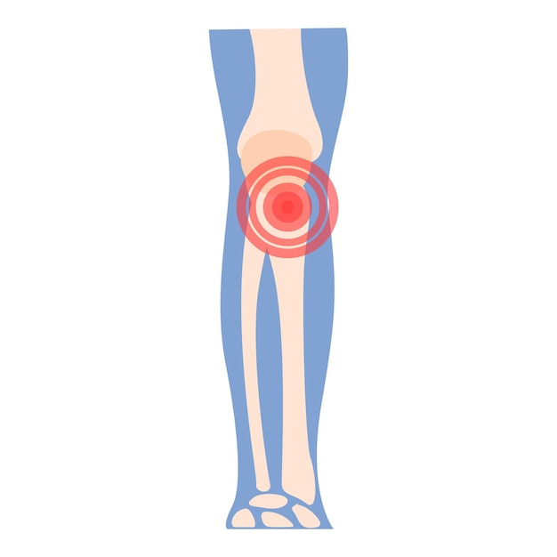 Vettore icona dell'artrite del ginocchio vettore cartoon dolore articolare medico