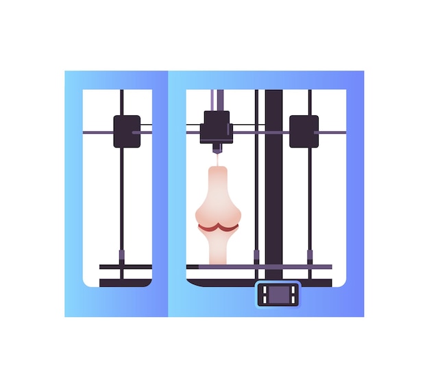 Knee joint model prints on 3d bio printer medical printing of human transplantation organ biological engineering bioprinting