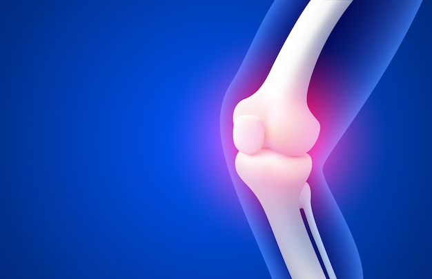 knee pain Xray of the leg 3D visualization Vector illustration