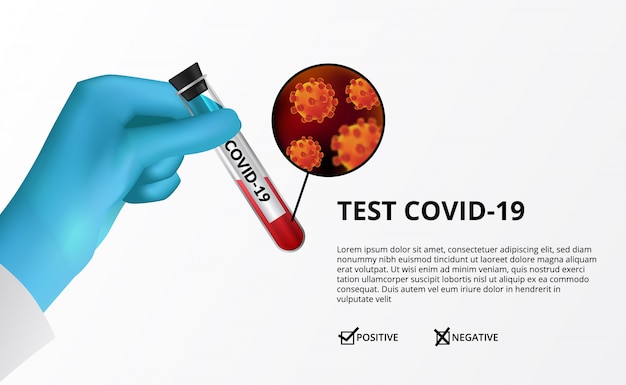 Vector laboratorium en ziekenhuis testen bloedmonster. resultatenrapport van positief van coronavirus (covid-19). handschoen met reageerbuis.