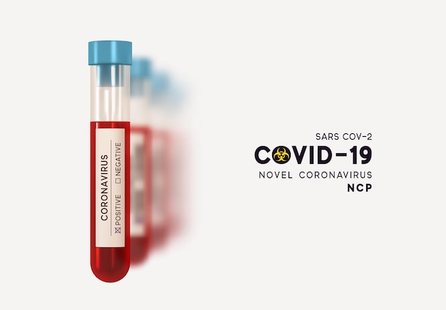 ウイルス Covid19 の血液検査。示されている新規コロナウイルス (2019-nCoV) は、一本鎖 RNA ウイルスです。 Covid 19-NCP。リアルな 3 d ガラス試験管。 SARS-CoV-2。ベクトル イラスト。