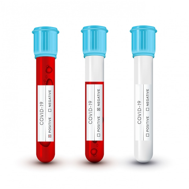 Vettore esame del sangue da laboratorio per il virus covid19. impostare una provetta di vetro realistica. il nuovo coronavirus -ncov indicato è un virus rna a singolo filamento.