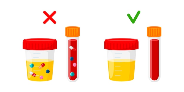 ドーピングのための臨床検査血液と尿中の薬の維持のための概念