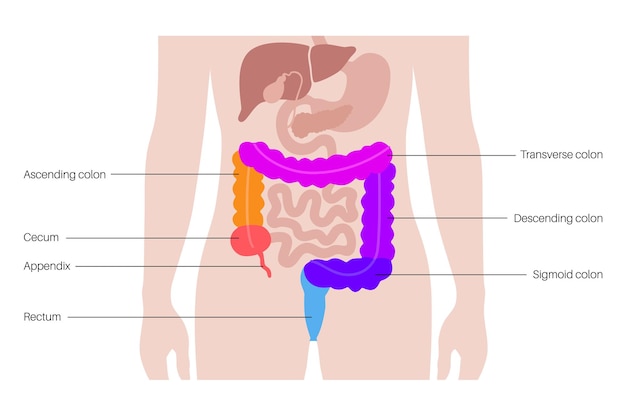 ベクトル 大腸の解剖学的ポスター人間の腸のセクション消化器科クリニックでの消化管の検査と治療教育分離ベクトル図のための結腸のインフォ グラフィック