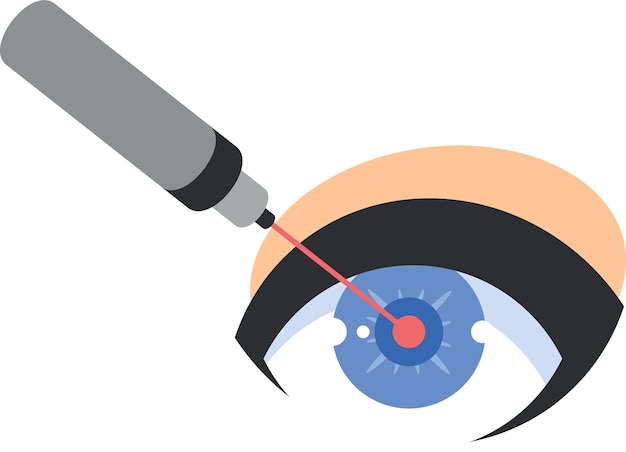 Laserchirurgie op een oog geïsoleerd op transparante achtergrond