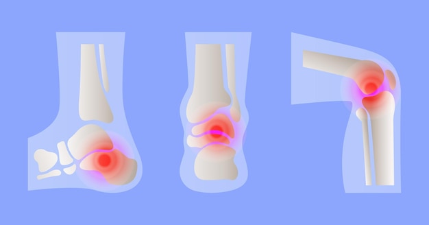 Vettore fondo di progettazione di dolore alle gambe con l'illustrazione di tecnologia medica