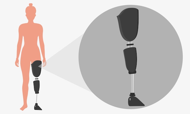 Вектор Ноги протез конечностей женщина протез искусственной ноги передний зум