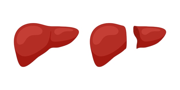 Levend donor rechter kwab levertransplantatie concept. menselijke exocriene klier orgaantransplantatie operatie concept. platte vectorillustratie