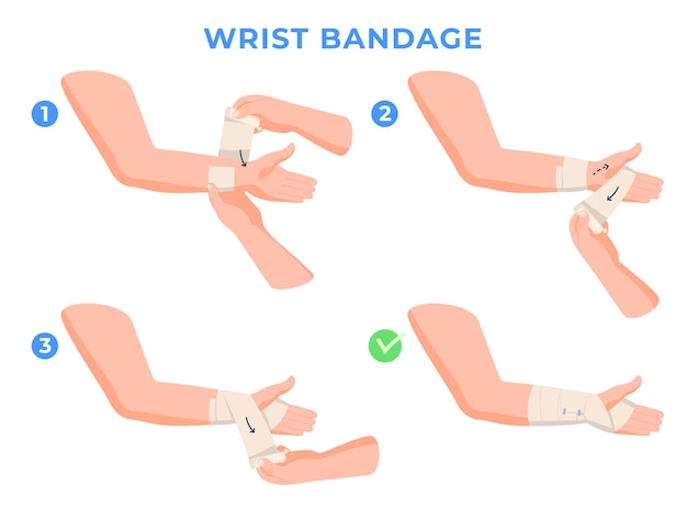 Istruzioni passo passo per il bendaggio degli arti aiutare con le lesioni alle mani bendaggio di una mano di una persona illustrazione vettoriale