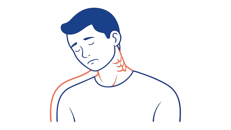 Vector line drawing of man with neck pain vector art illustration