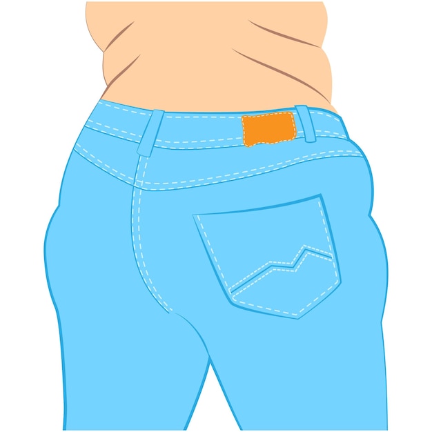 Липедема бедер. толстая женщина в синих джинсах
