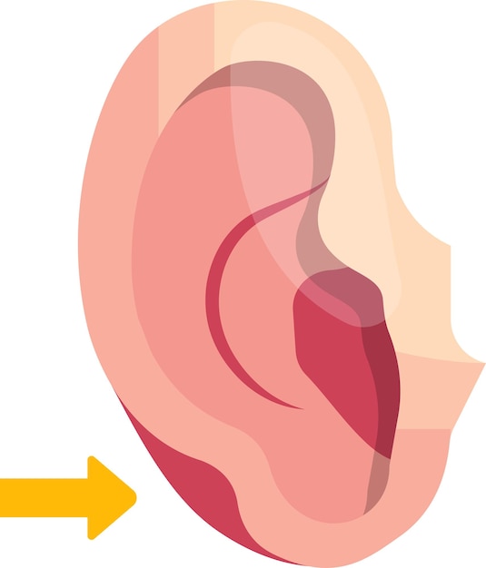 Escissione di lipoma chirurghi plastici disegno vettoriale bellezza e cura personale corpo di dermatologia cosmetica