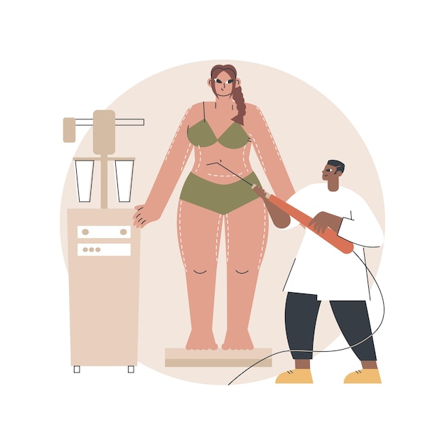 Vector liposuction concept illustration