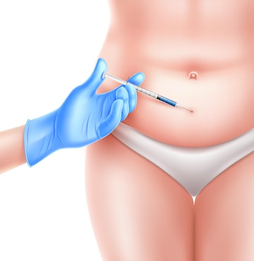 Premium Vector | Liposuction surgery. doctor hand in sterile blue glove  with syringe making lipolytic injection to obese overweight naked woman body