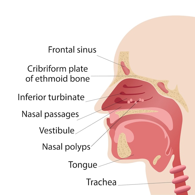 Vector longitudinal section of the diagram of the anatomy of the human nose polyps of the nose