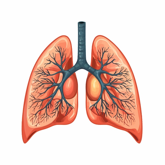 Vettore lung_cancer_diagram_in_details_vector