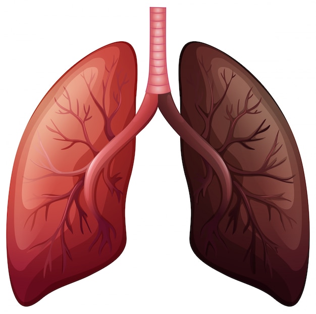 Lung cancer diagram in large scale