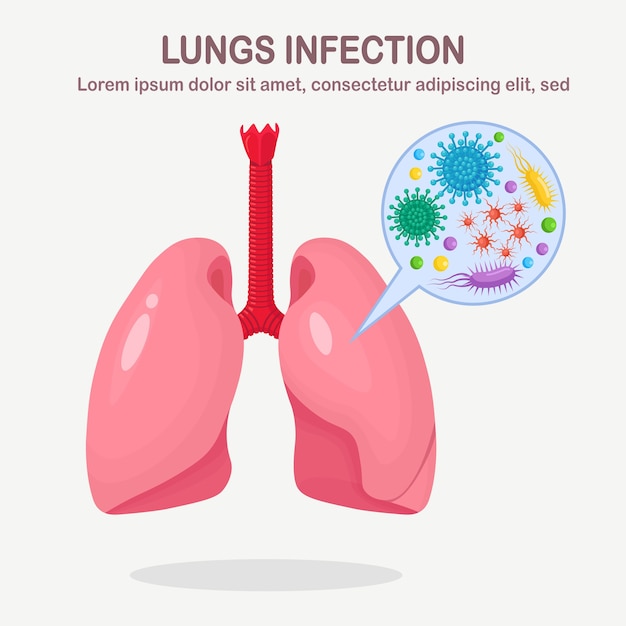 Lungs with respiratory infection. bacteria, microbes, germs in human organs.