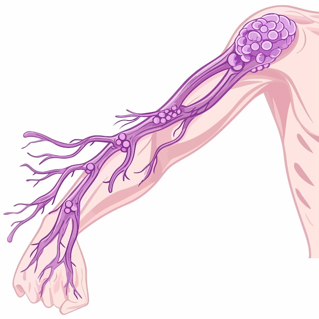 Vettore lymph_nodes_of_female_armpit_vector