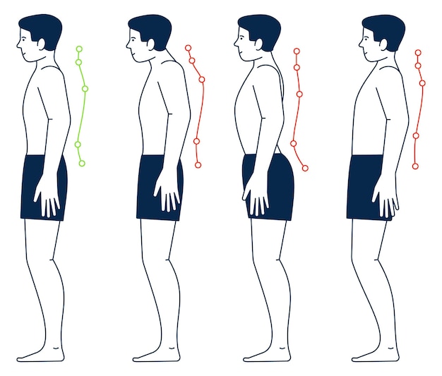 척추의 옳고 그른 자세를 가진 남성의 몸 몸의 자세