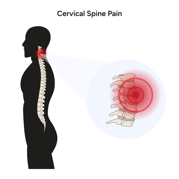 male silhouettes and cervical spine pain in vector