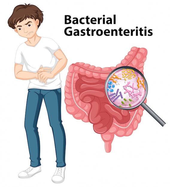 Vector man and diagram showing bacterial gastroenteritis