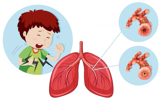 Vector a man having chronic obstructive pulmonary disease