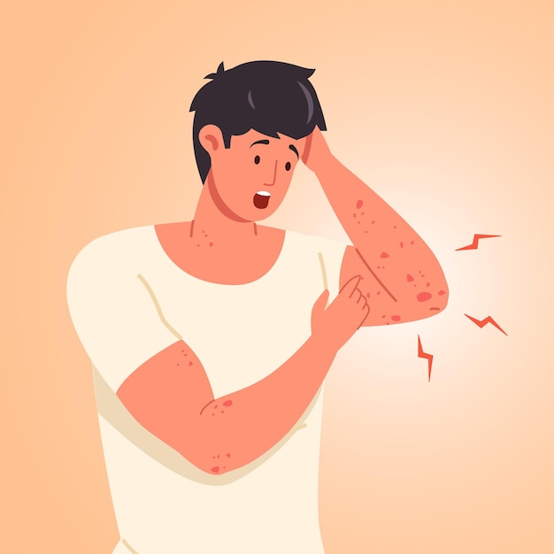 Vector man scratching skin guy scratch sensitive skins on itchy hand scabies eczem rash inflammation or chickenpox symptom mosquito infection food allergy concept vector illustration of skin allergy itchy