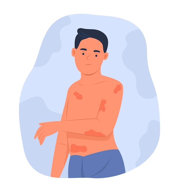 Vector man with atopic dermatitis or eczema on body
