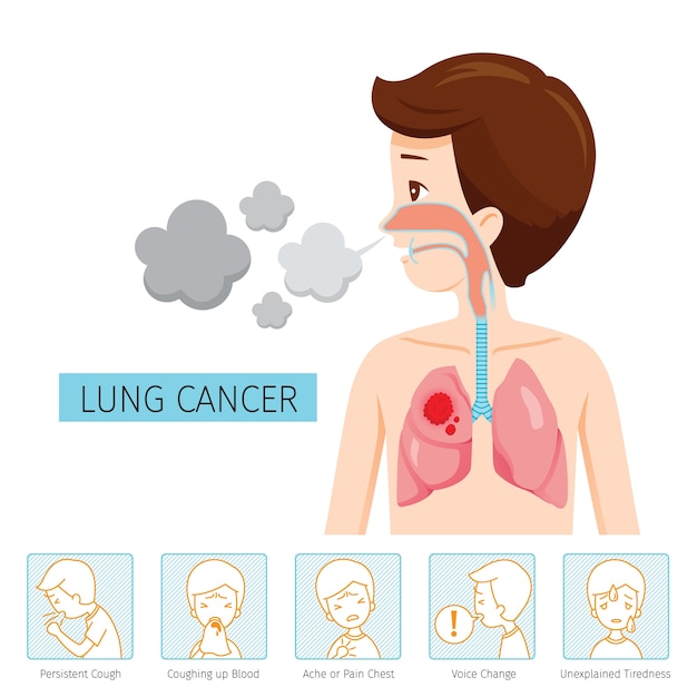 Man With Lung Cancer Diagram And Symptoms illustration