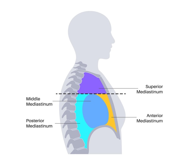 Vector mediastinum infographic poster