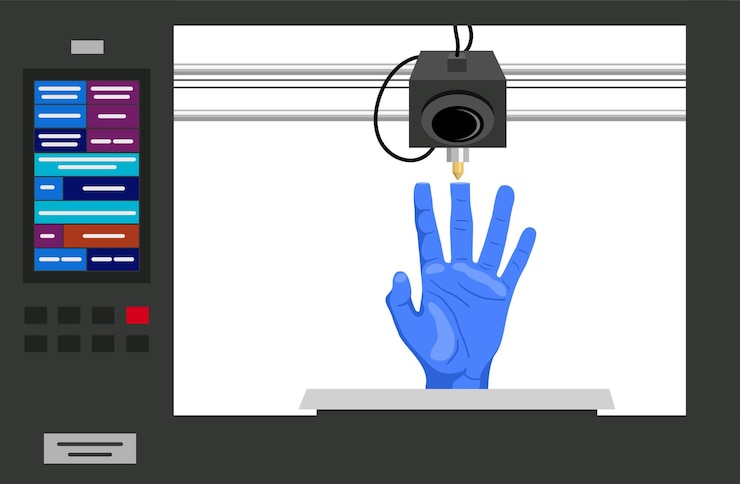 Vector medical 3d printing process of a prosthetic hand technology to print a prosthetic hand prosthetics