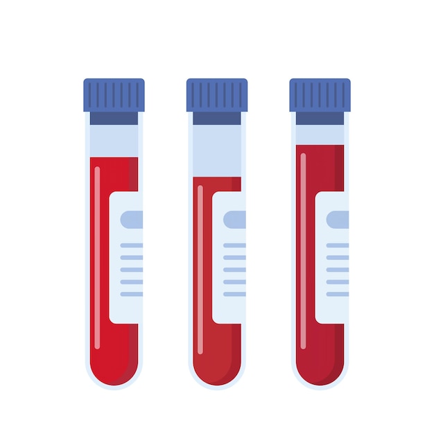 Medical flask icons with blood Blood test tubes with labels Vector Illustration in flat style