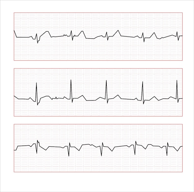 Vettore cardiofrequenzimetro medico che misura la frequenza cardiaca