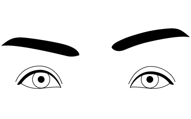 Vector medical illustration diagram of mild ptosis eyelid drooping