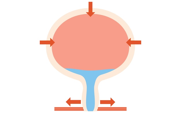 ベクトル 正常な膀<unk>の医学的イラスト 排尿と排尿の方法