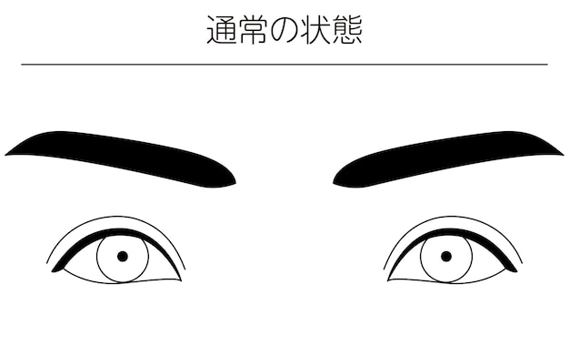 Medical illustrations diagrammatic line drawings of eye diseases strabismus and normal conditions