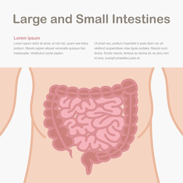 Medical infographic showing the structure of the human intestines