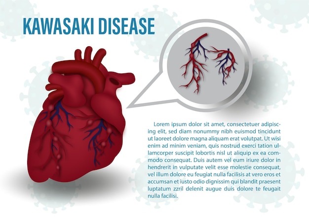 벡터 벡터 디자인의 가와사키병 의료 포스터