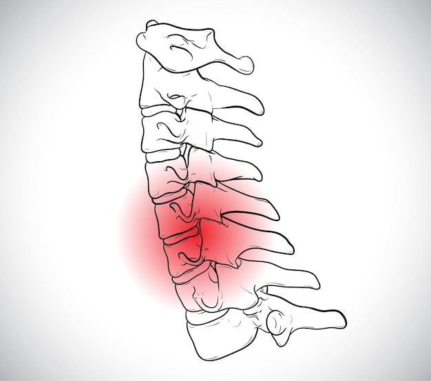 Medically correct vertebrae of the cervical spine