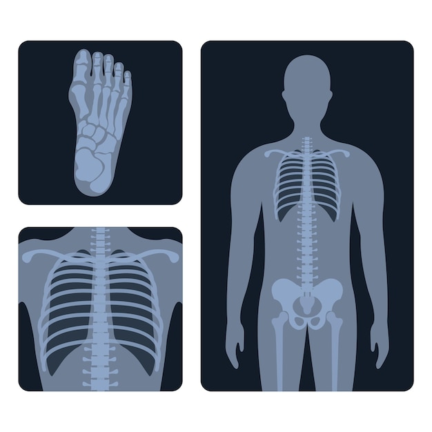 Vector medische radiologie. verschillende röntgen- of radiografische beelden van botten en delen van het menselijk lichaam