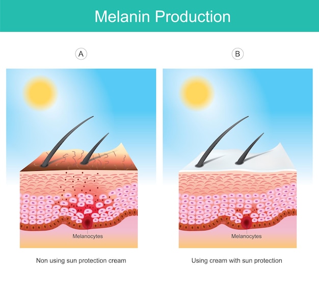 Produzione di melanina. illustrazione che mostra il colore della pelle umana influenzare dai raggi uv la causa delle stimolazioni delle cellule melanocitarie negli strati della pelle.