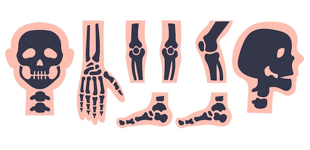 Menselijk skelet x-straal geneeskunde diagnostische geïsoleerde set Vector plat grafisch ontwerp illustratie