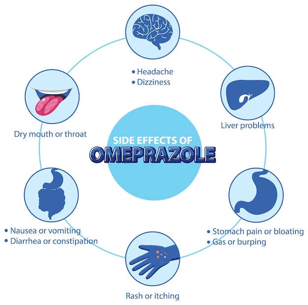 Menselijke anatomie diagram cartoon stijl van omeprazol bijwerkingen