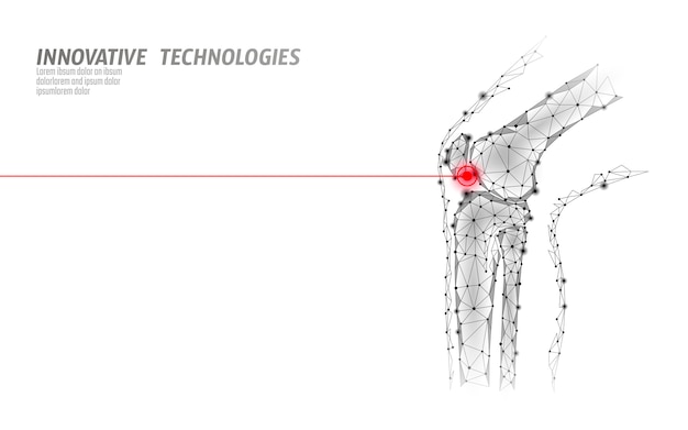 Vector menselijke kniegewricht 3d model vectorillustratie. laag poly ontwerp toekomstige technologie genezen pijnbehandeling.