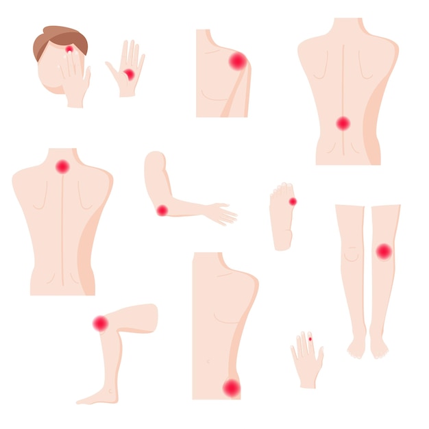 Menselijke lichaamsdelen met pijnzones vector plat geïsoleerde illustratie