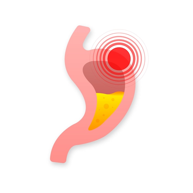 Menselijke maag gezonde en ongezonde anatomie van het spijsverteringsstelsel vector stock illustratie
