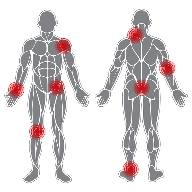 Vector menselijke zwakke gewrichten