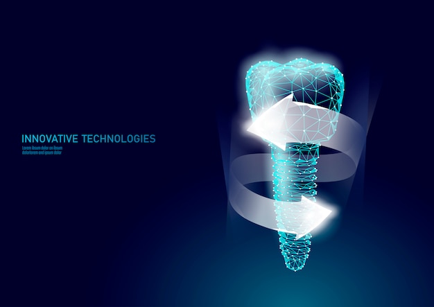 Vector molar tooth dental implant 3d low poly geometric model.